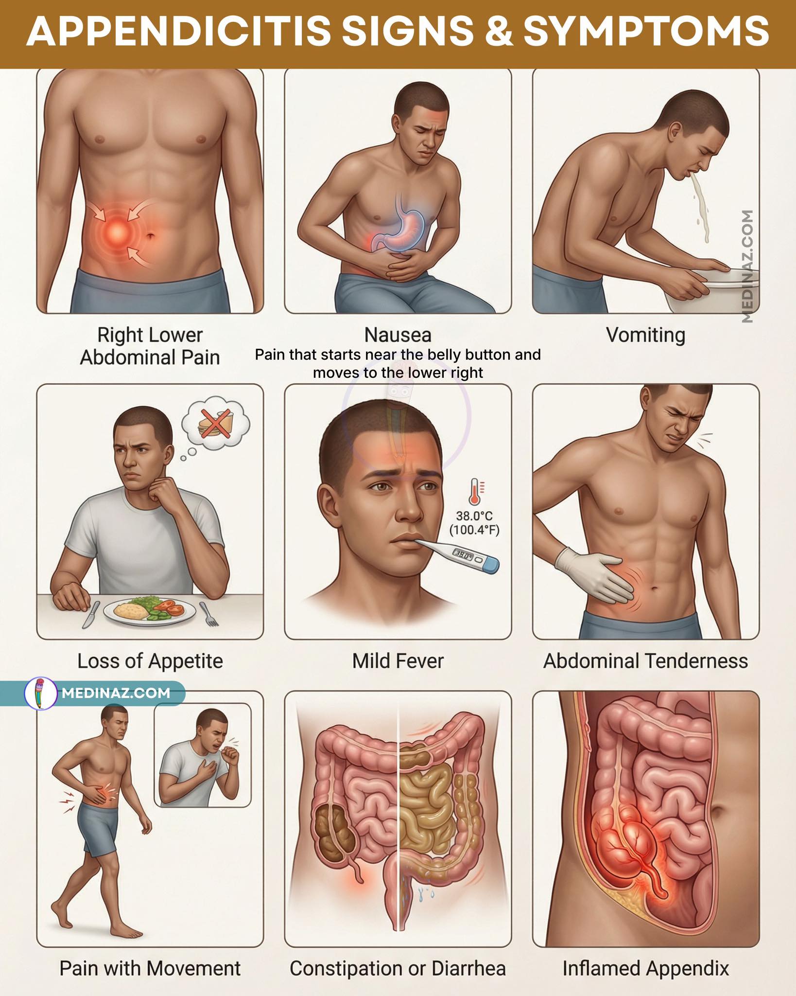 appendicitis glp 1 does tirzepatide cause What are the common side effects of (Dual GIP and GLP-1 receptor agonist)? Understanding Tirzepatide Side Effects, Burst appendix misdiagnosed as GLP1