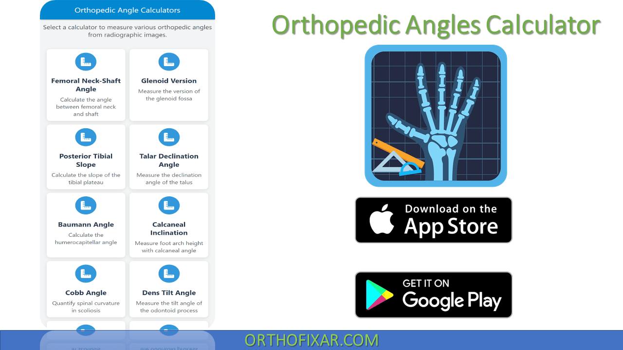 Geniohyoid Muscle... - OrthoFixar - Orthopedic Surgery | Facebook