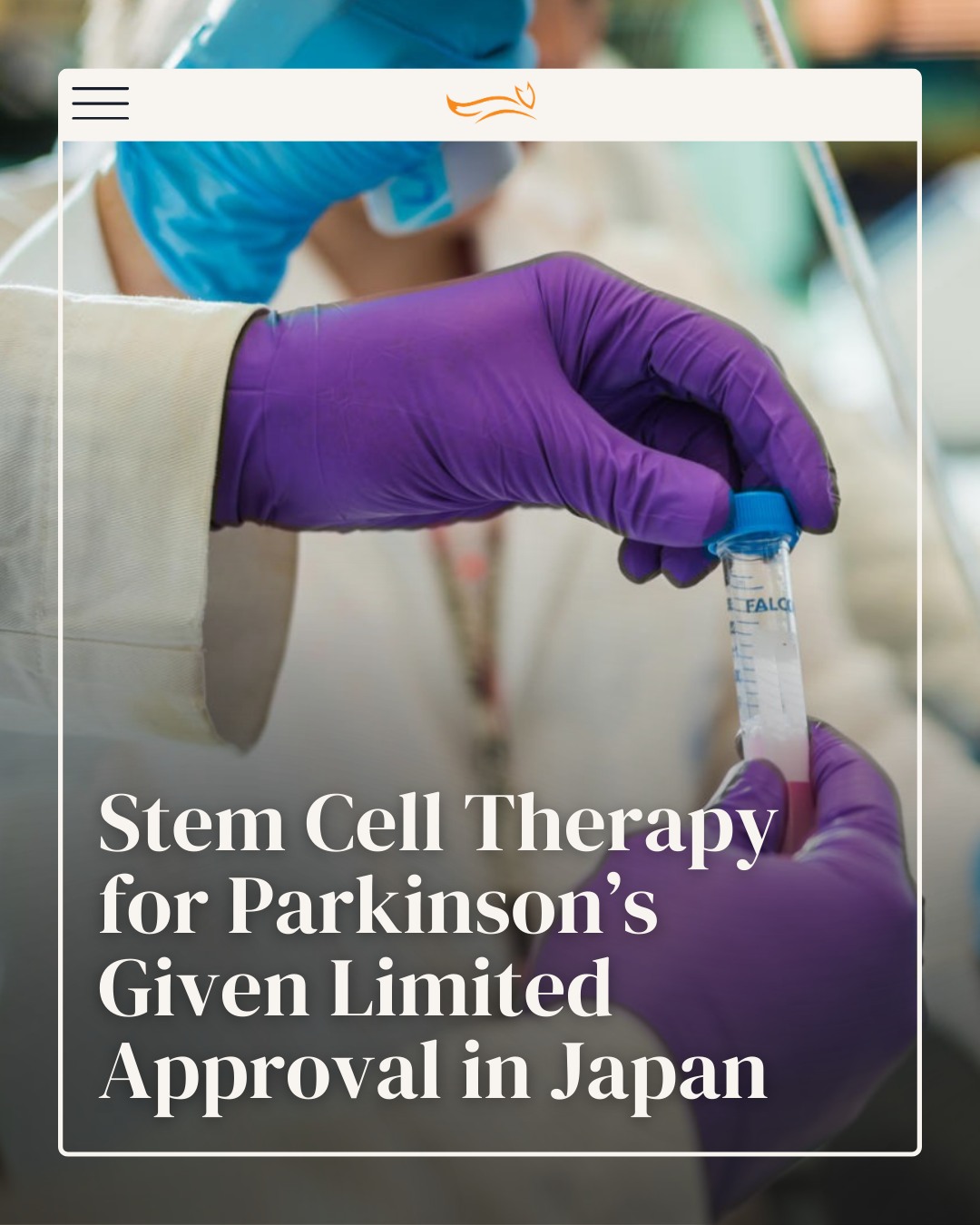 iv glutathione for parkinson& 39 A stem cell-based dopamine neuron replacement therapy the treatment of Parkinson's motor symptoms has received conditional, limited approval in Japan — a first for this type of therapy. The therapy, developed Size:4oz Glass Dropper Bottle Is Glutathione Safe for 카테고리_뷰티_로션