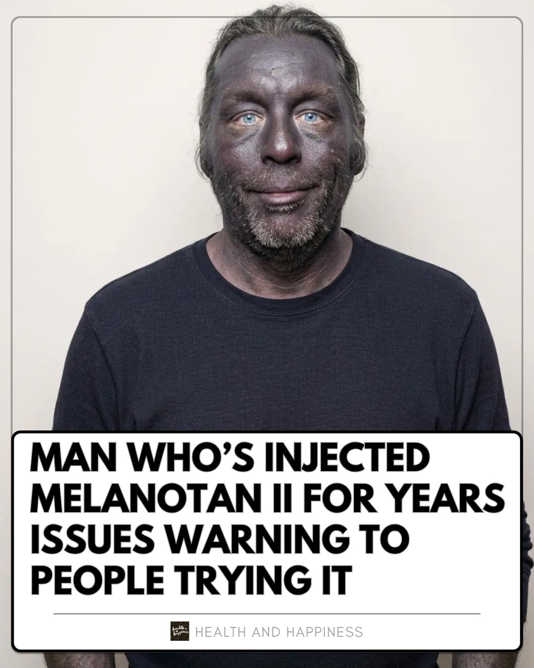 melanotan depression II in Santa Barbara, CA A man who used Melanotan