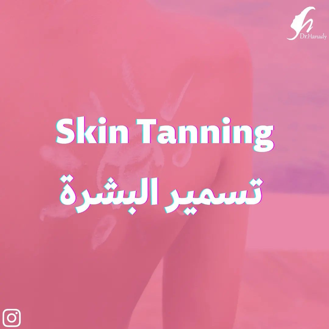 Dr.Hanady - التسمير... التان 