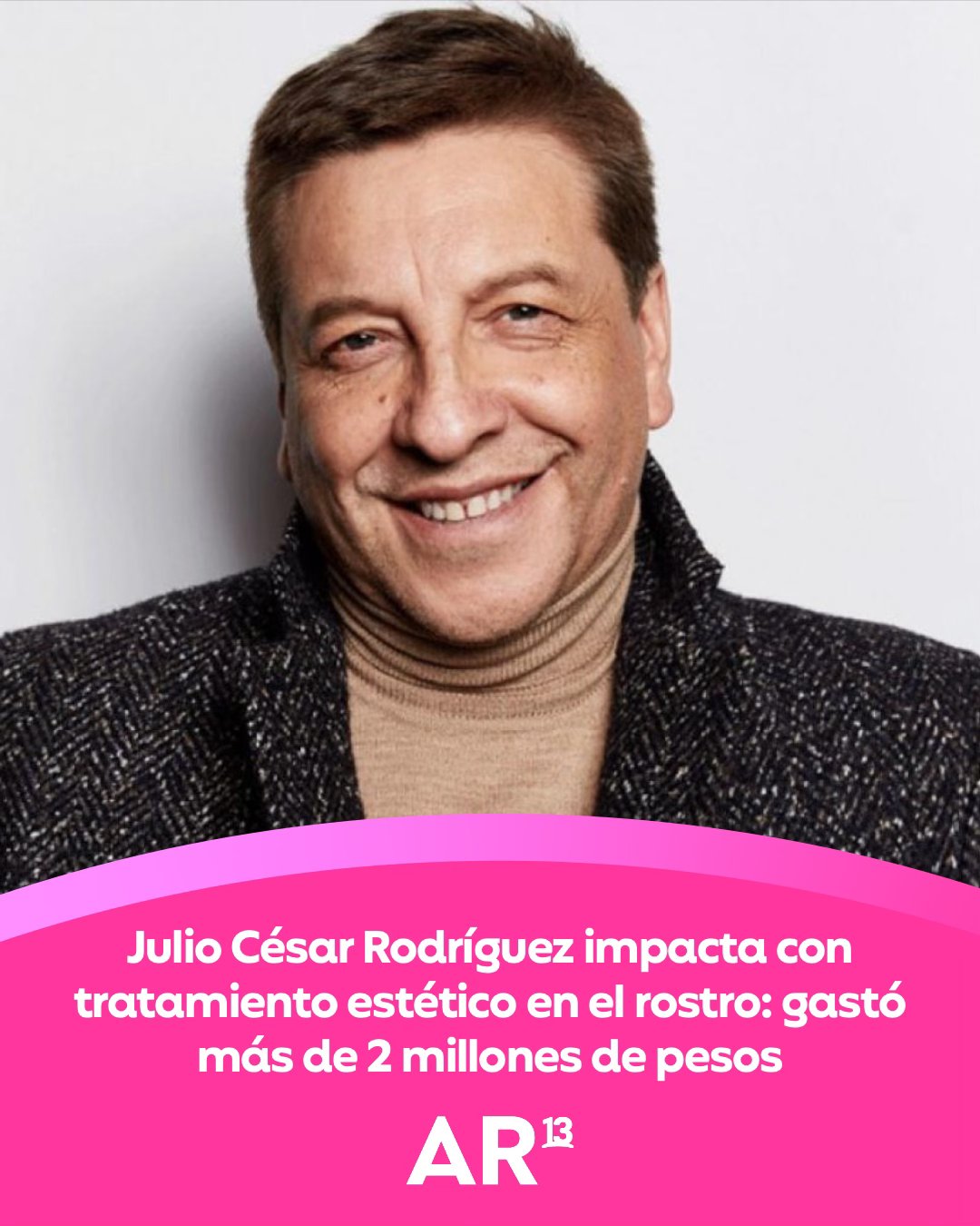 Canal - Julio César Rodríguez impacta con tratamiento estético en el ...