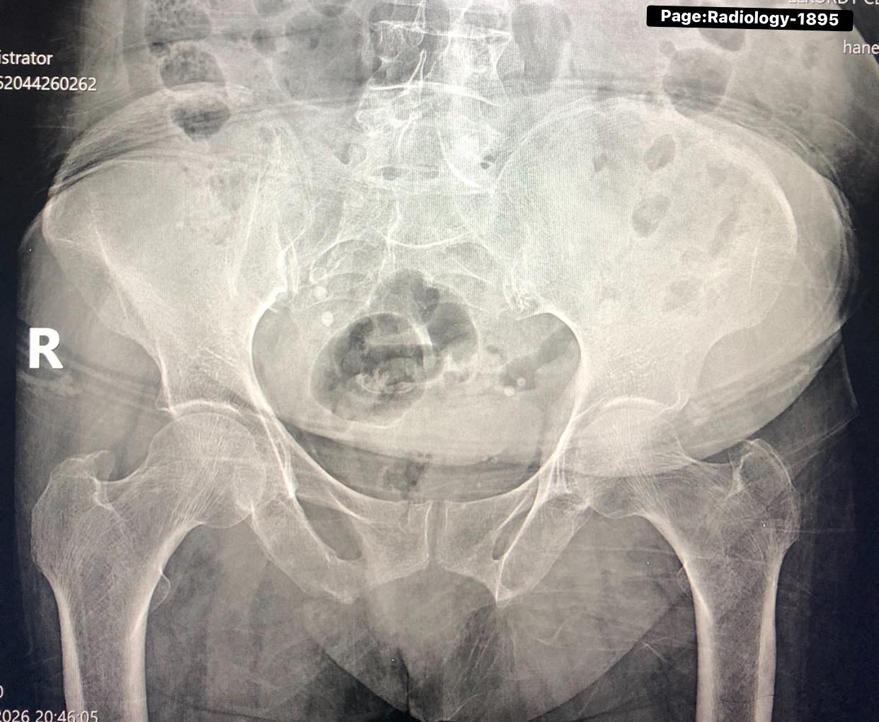 Radiology - X-ray Both Hips Diagnosis ⁉️ | Facebook