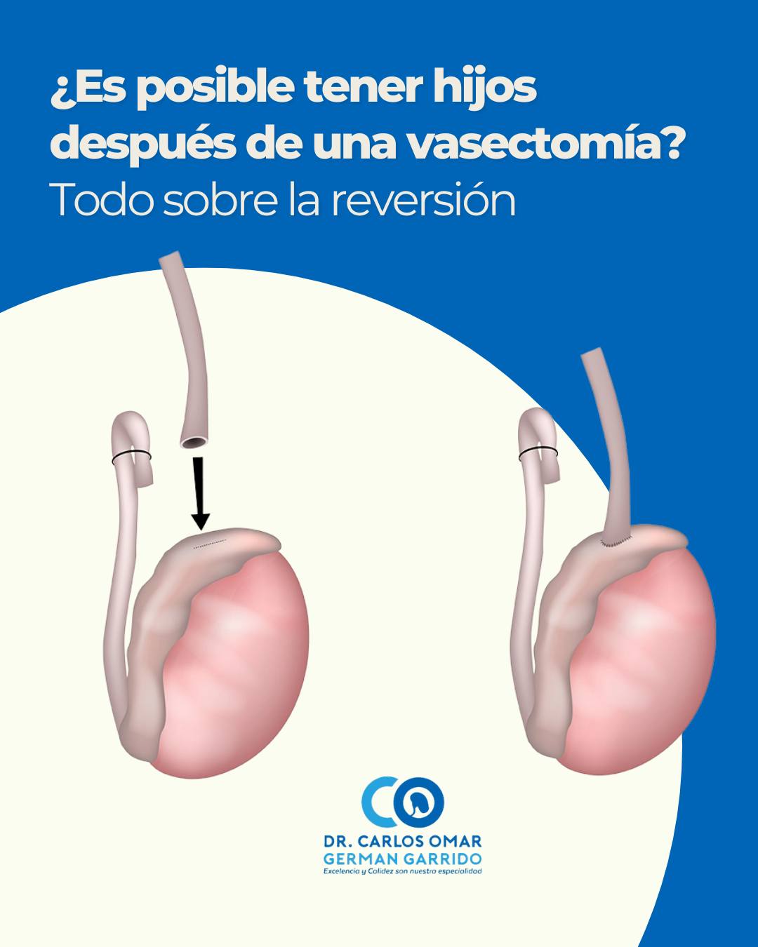 La próstata es una... - Dr. Carlos Omar German Garrido | Facebook