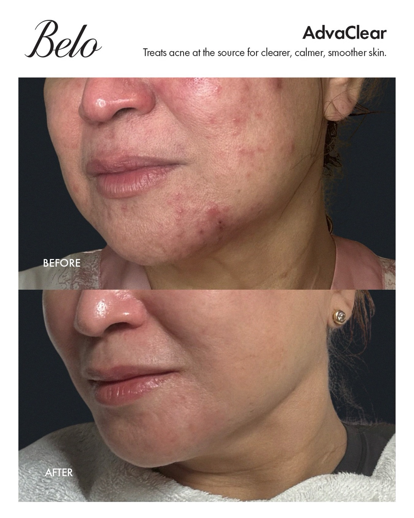 Belo Medical Group Philippines (@Belo.Medical) • Facebook