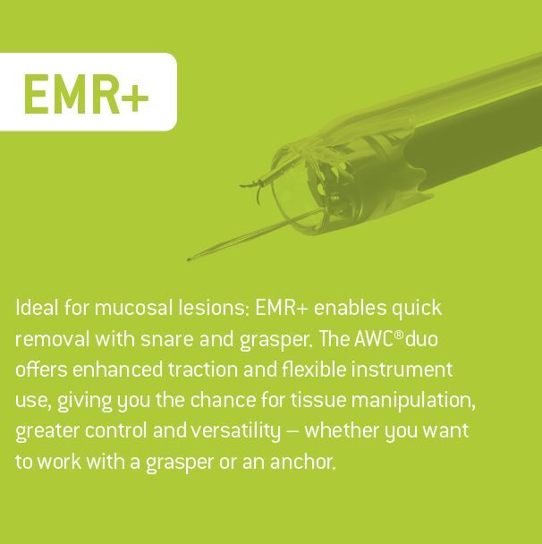 Unlock new possibilities in... - Ovesco Endoscopy AG | Facebook