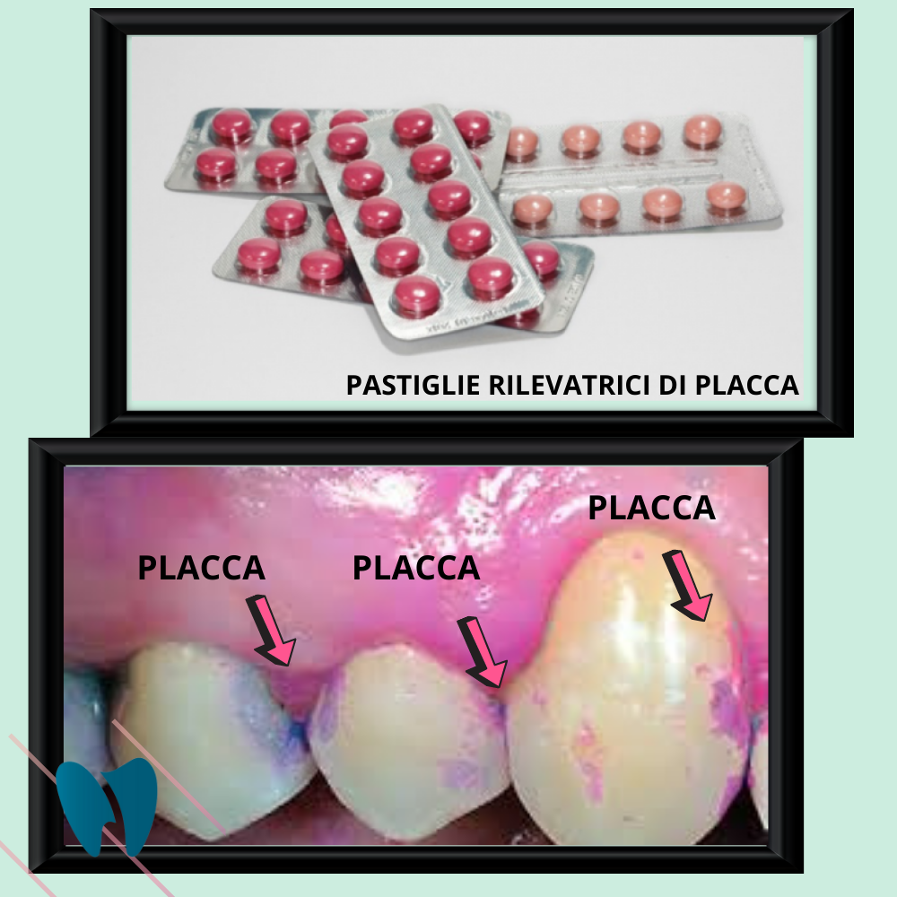 studio-dentistico-dr-ssa-loredana-vallone-sapevate-che-c-un-modo