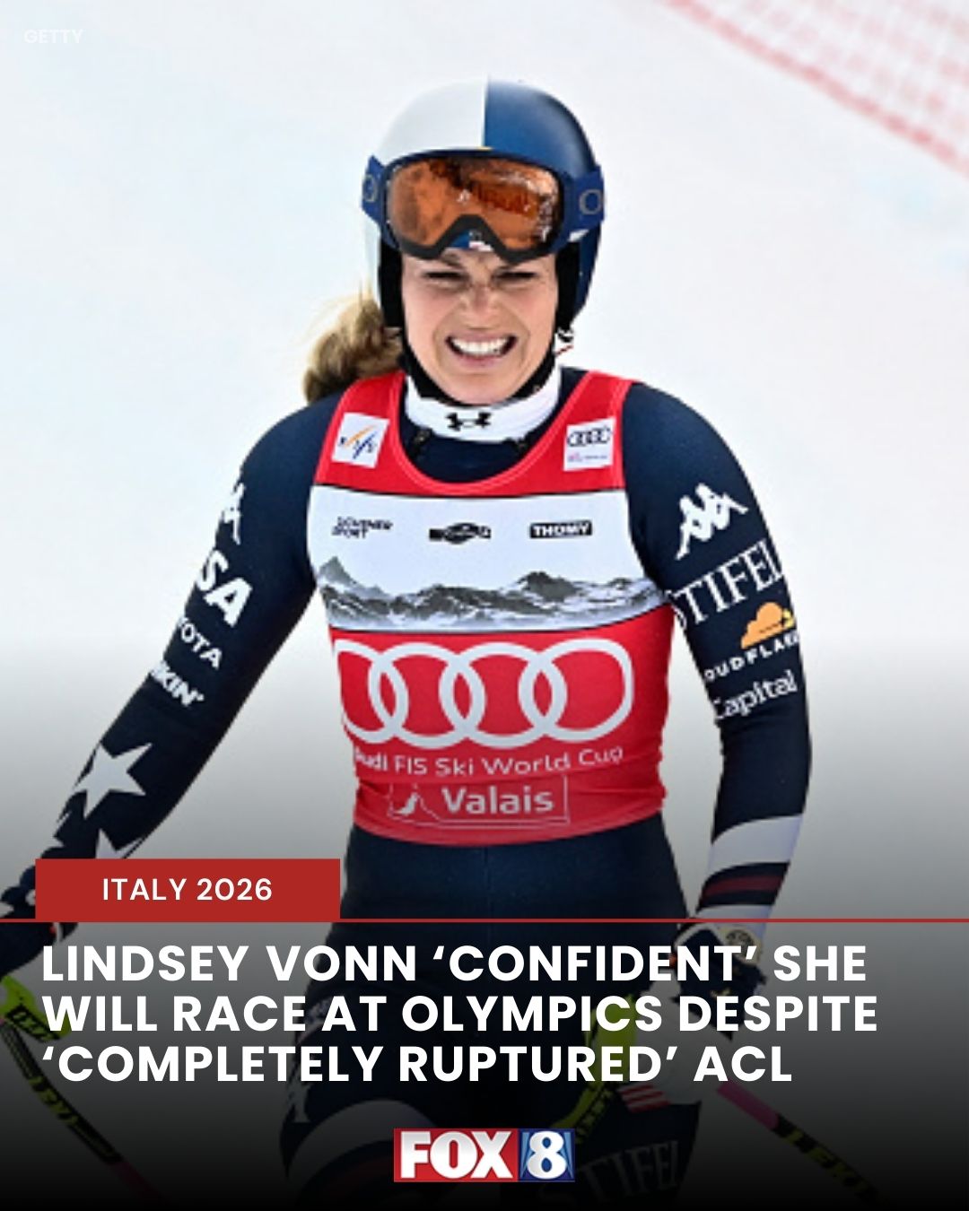 Fox - Lindsey Vonn says she has 