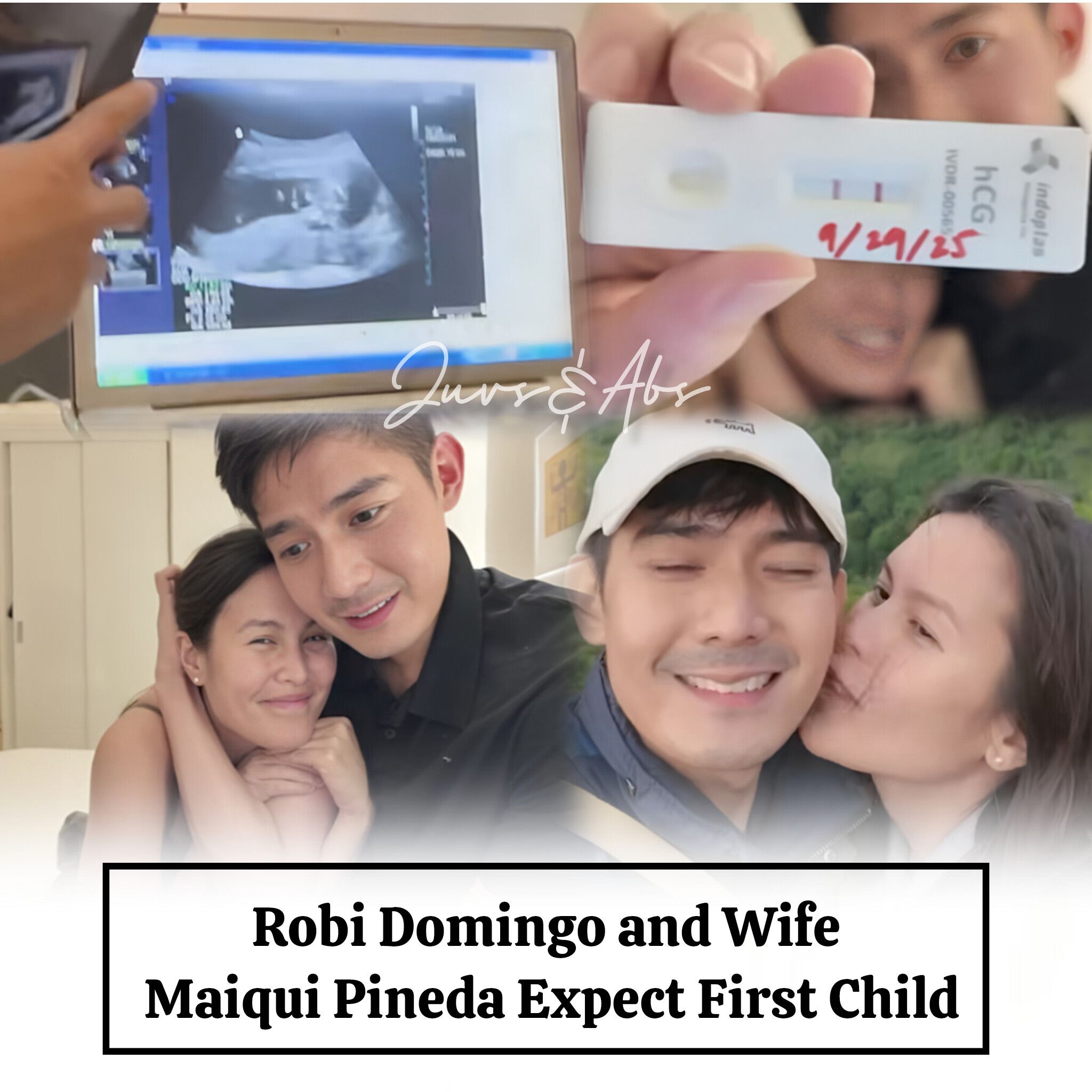 Juvs&Abs - Robi Domingo and Wife Maiqui Pineda Expect... | Facebook