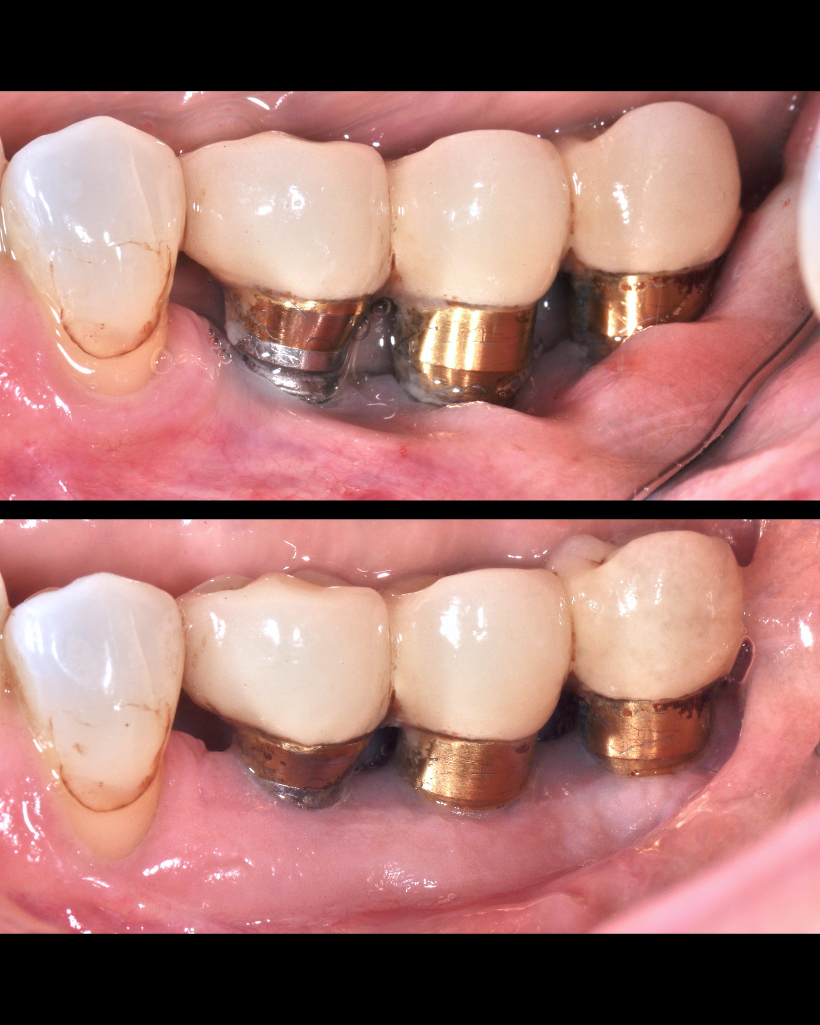 seacoast-periodontics-and-dental-implants-portsmouth-nh