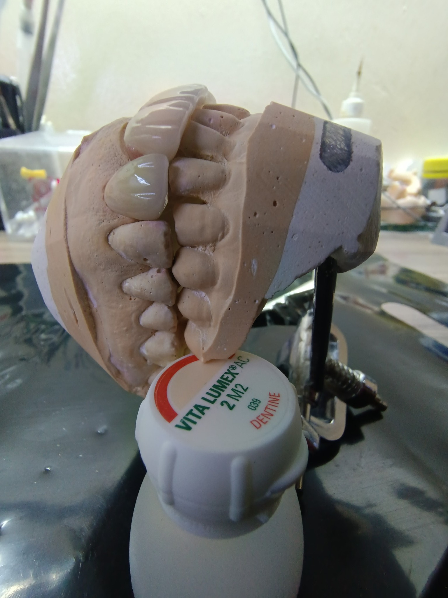 Almas Lab