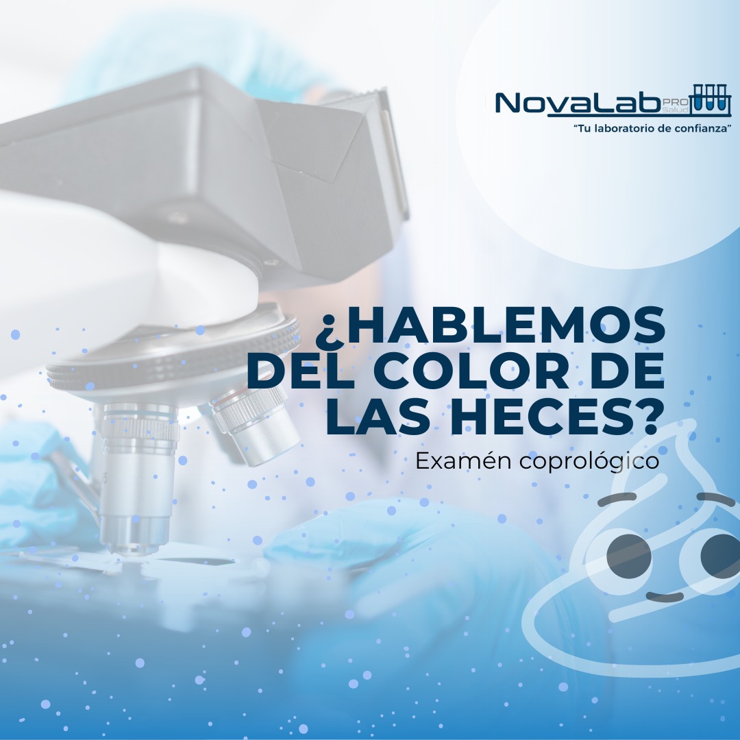 ️¿Alguna vez has pensado en el color... - NovaLab ProSalud | Facebook