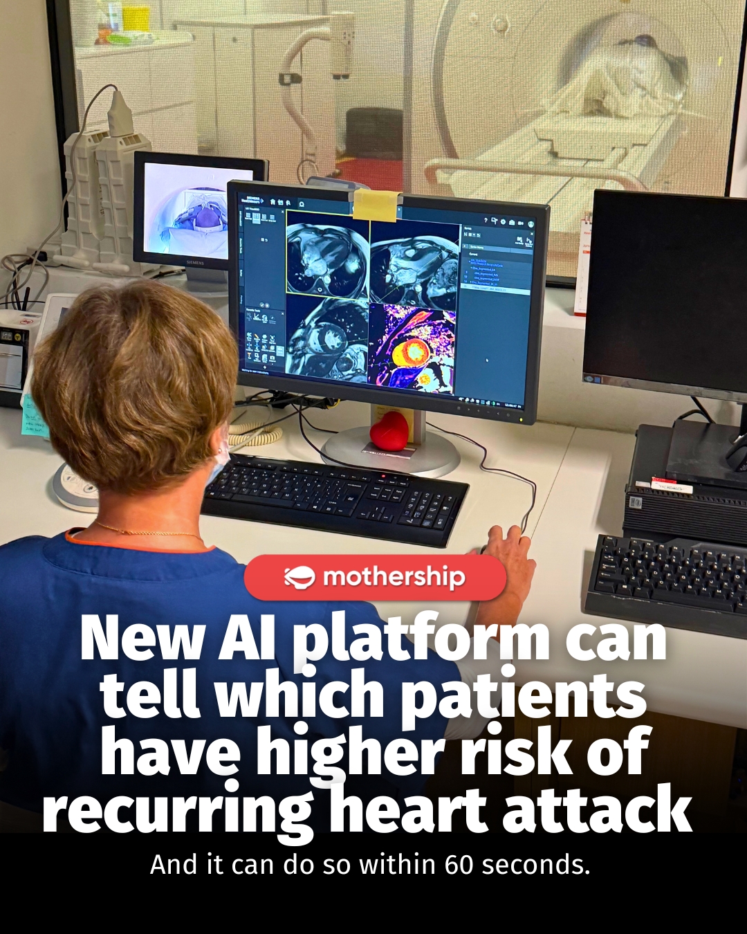 Heart attacks can leave behind hidden damage. Now, AI is helping