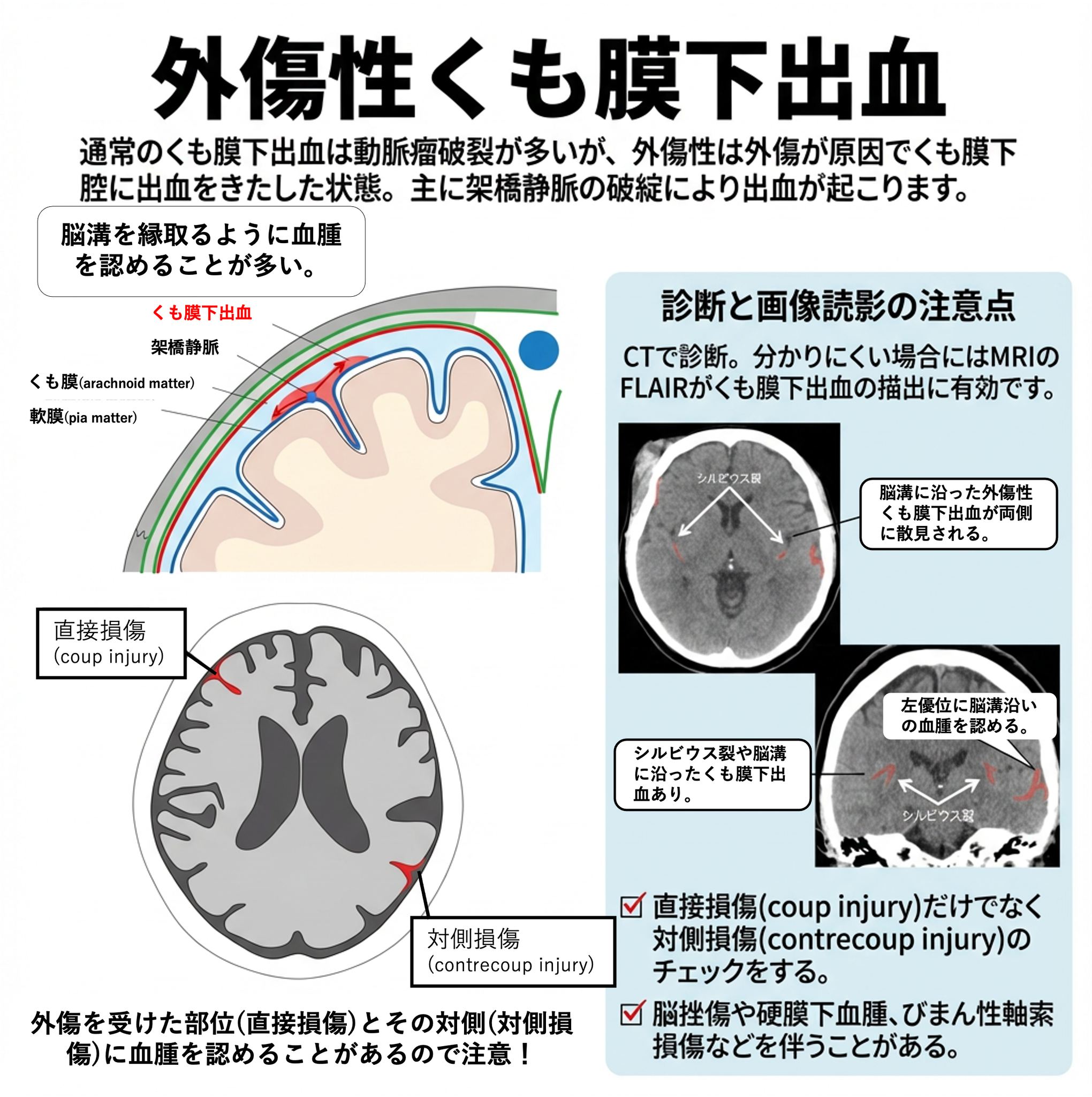画像診断cafe - 外傷性くも膜下出血の画像診断のポイントについてまとめました。 詳しくはこちら https://xn