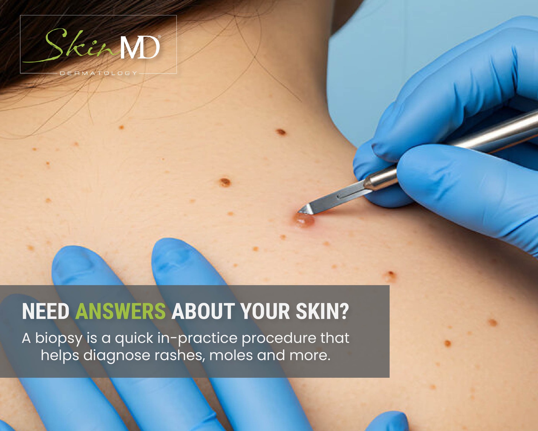 Skin MD Dermatology - Most of us have bumpy, itchy, scaly, or red skin ...