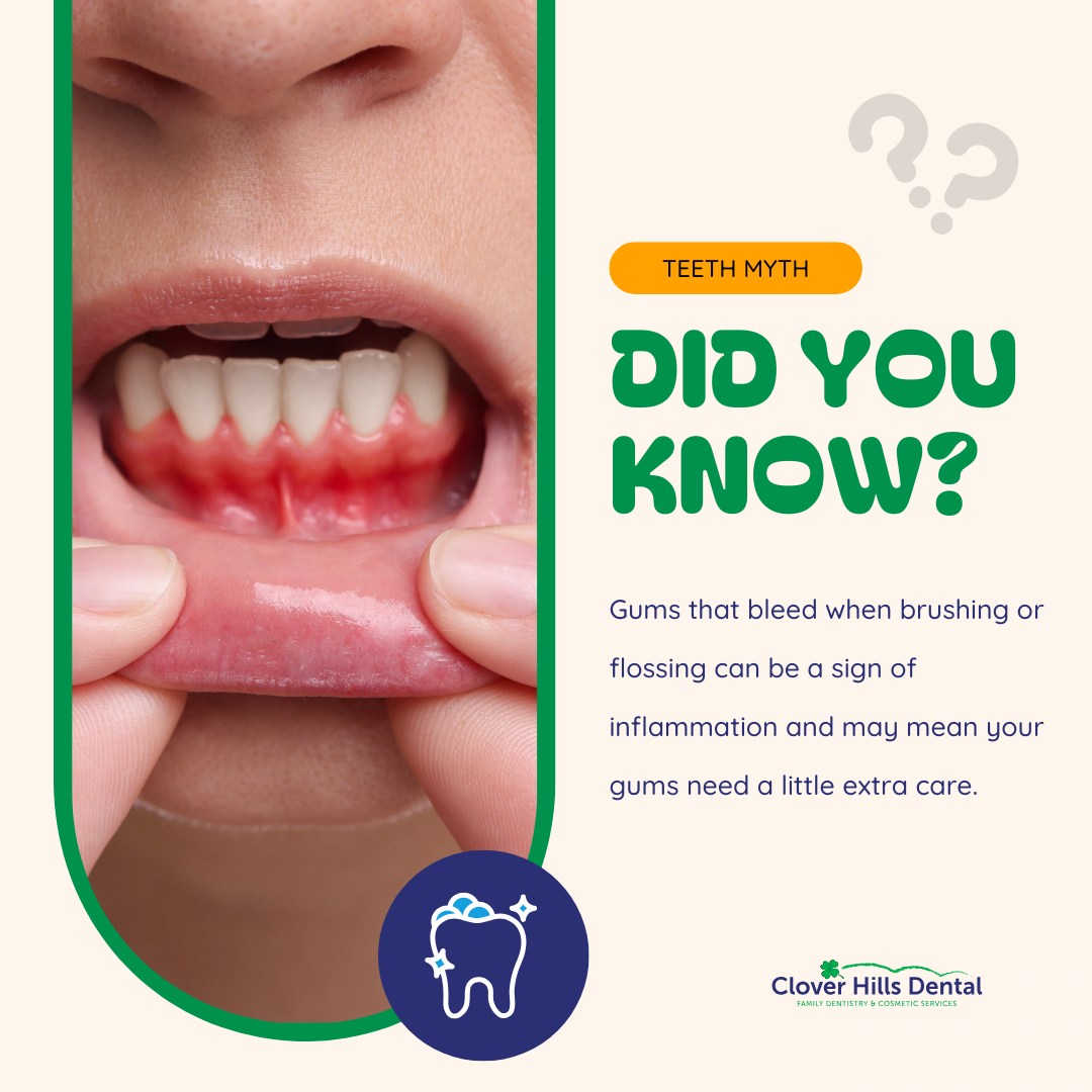 👀 Did you know? Myth: Bleeding gums... - Clover Hills Dental | Facebook