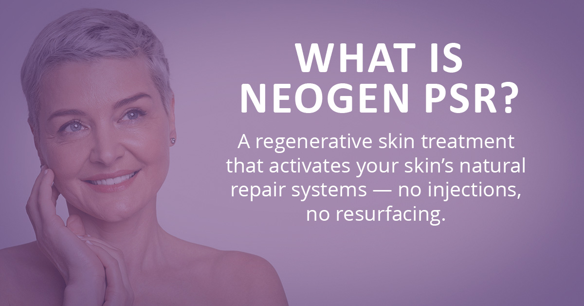 Siskiyou - WHAT IS NEOGEN PSR? NeoGen PSR is a regenerative skin ...