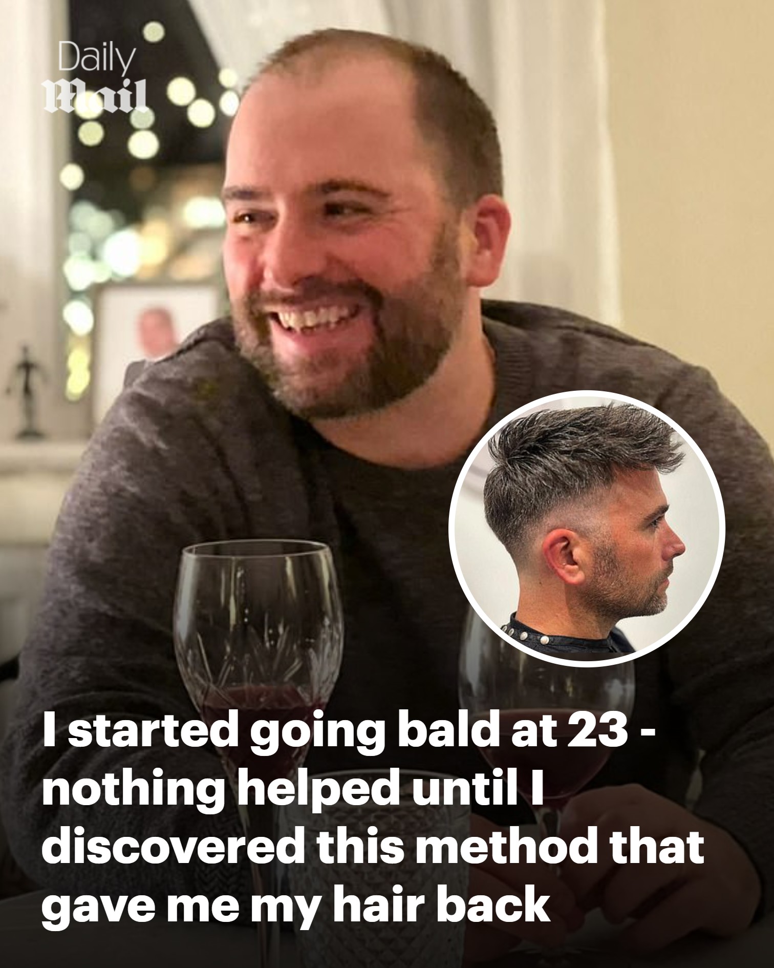ghk-cu before and after reddit Having hair again gave me a new boost.' Read more: https://trib.al/epNKu8W Research Compounds | Infinity Liver Size:3mL