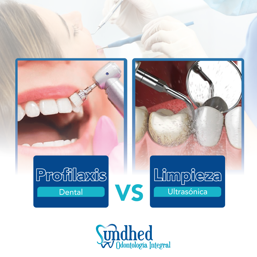 Sundhedec - 💥Profilaxis dental es el tratamiento que aplica una ...