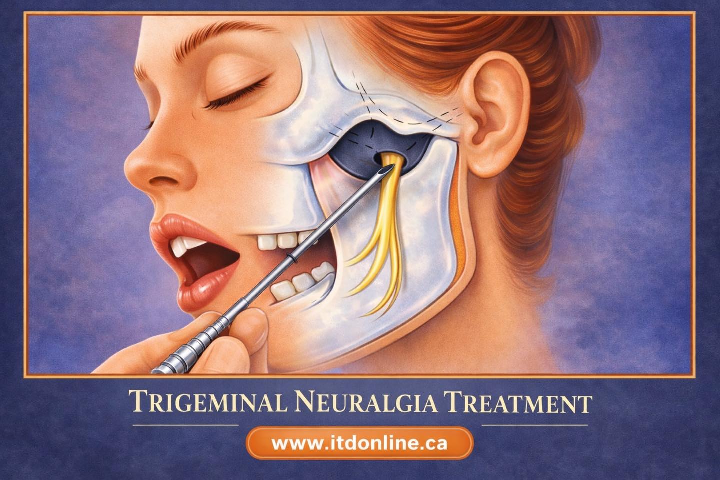 b12 injections for trigeminal neuralgia Vitamins treatment? 30ml Bacteriostatic Water and maintain balance naturally FDA Clears BPC-157 & Weight:2mg