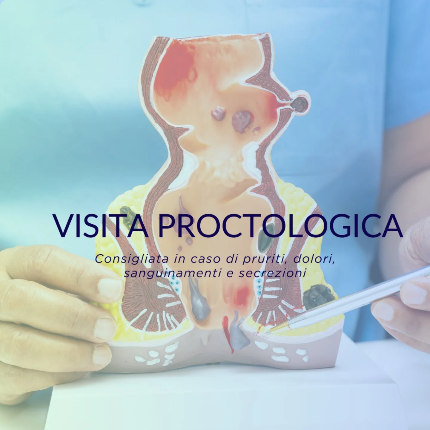 Nuova - ⭐ I NOSTRI SERVIZI: LA VISITA PROCTOLOGICA ⭐ COSA E’ E ...