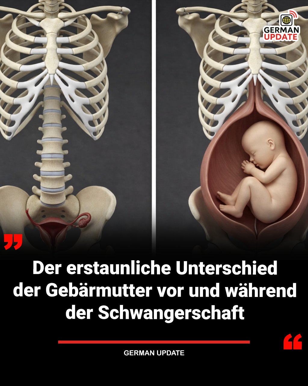 Wassermelone In Der Schwangerschaft