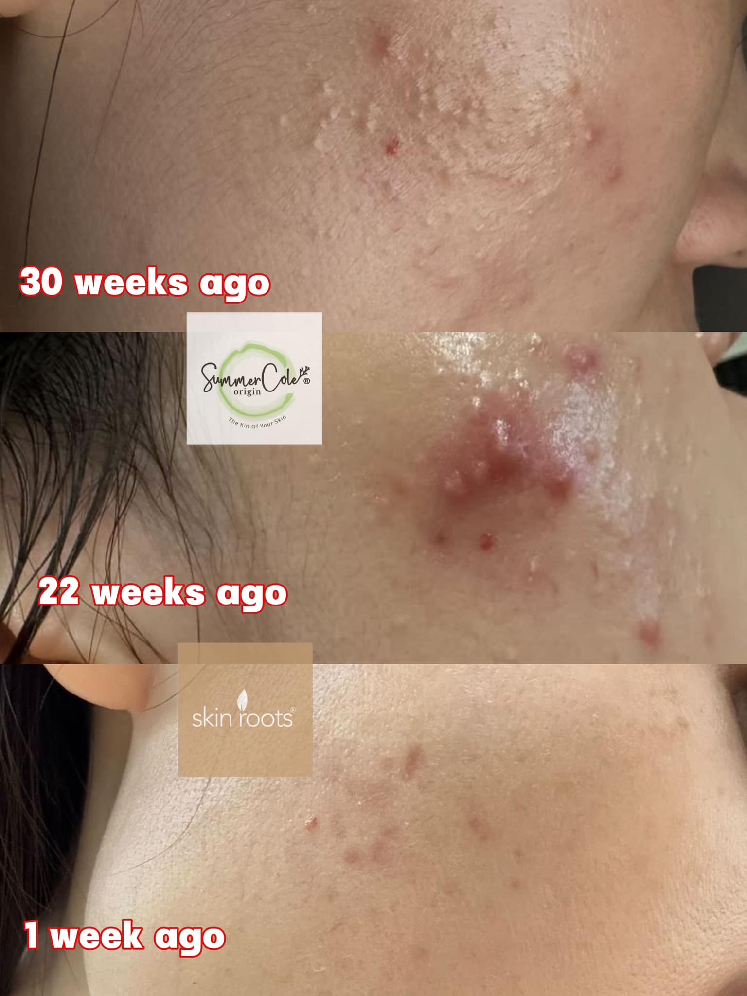 Skin Roots, Malaysia | Penang Island