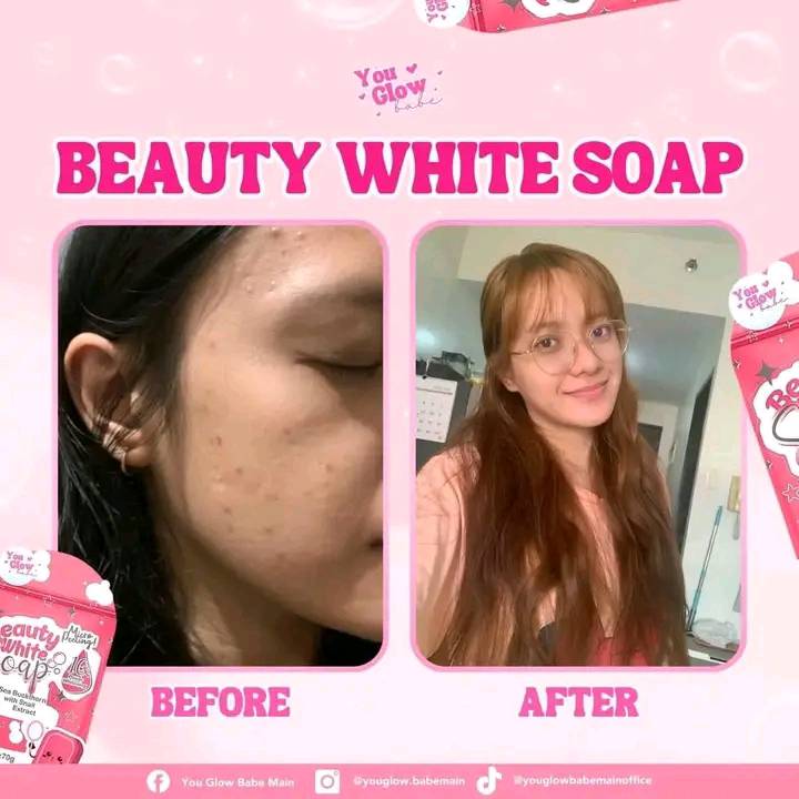 Precious skin extra pure gluta white soap review