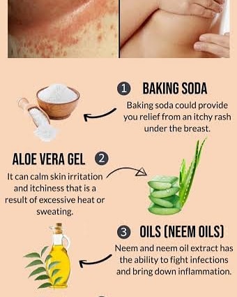 Do Diet - Dietitian Dr. Priti's diet clinic - RASHES UNDER BREAST (HOME ...