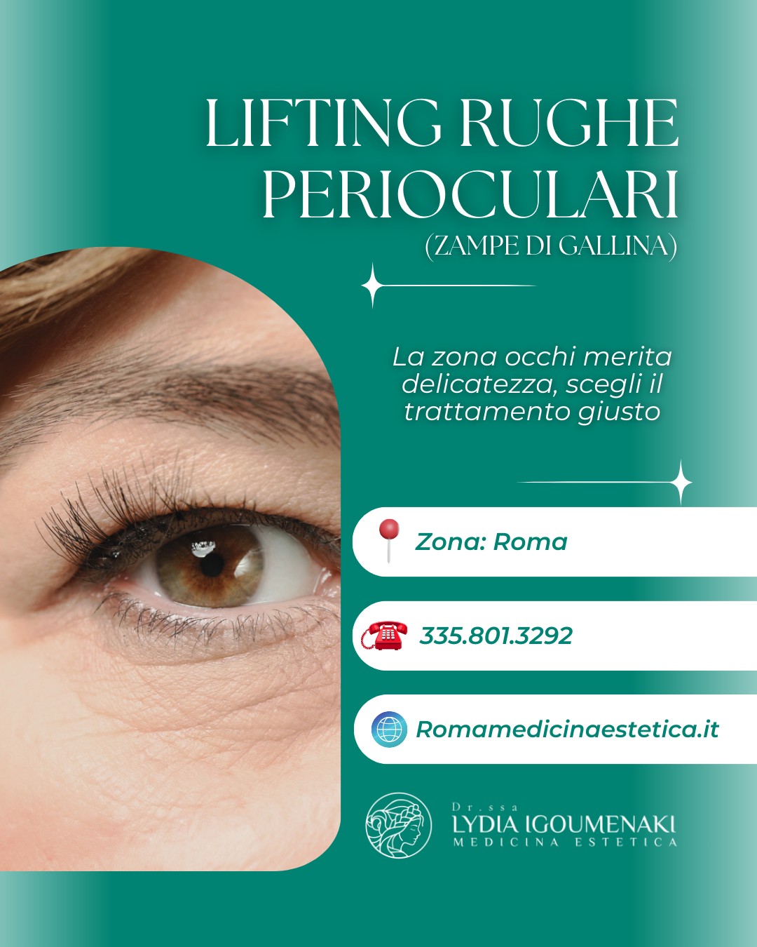 Dr - Lifting rughe perioculari: addio zampe di gallina! Le rughe ...