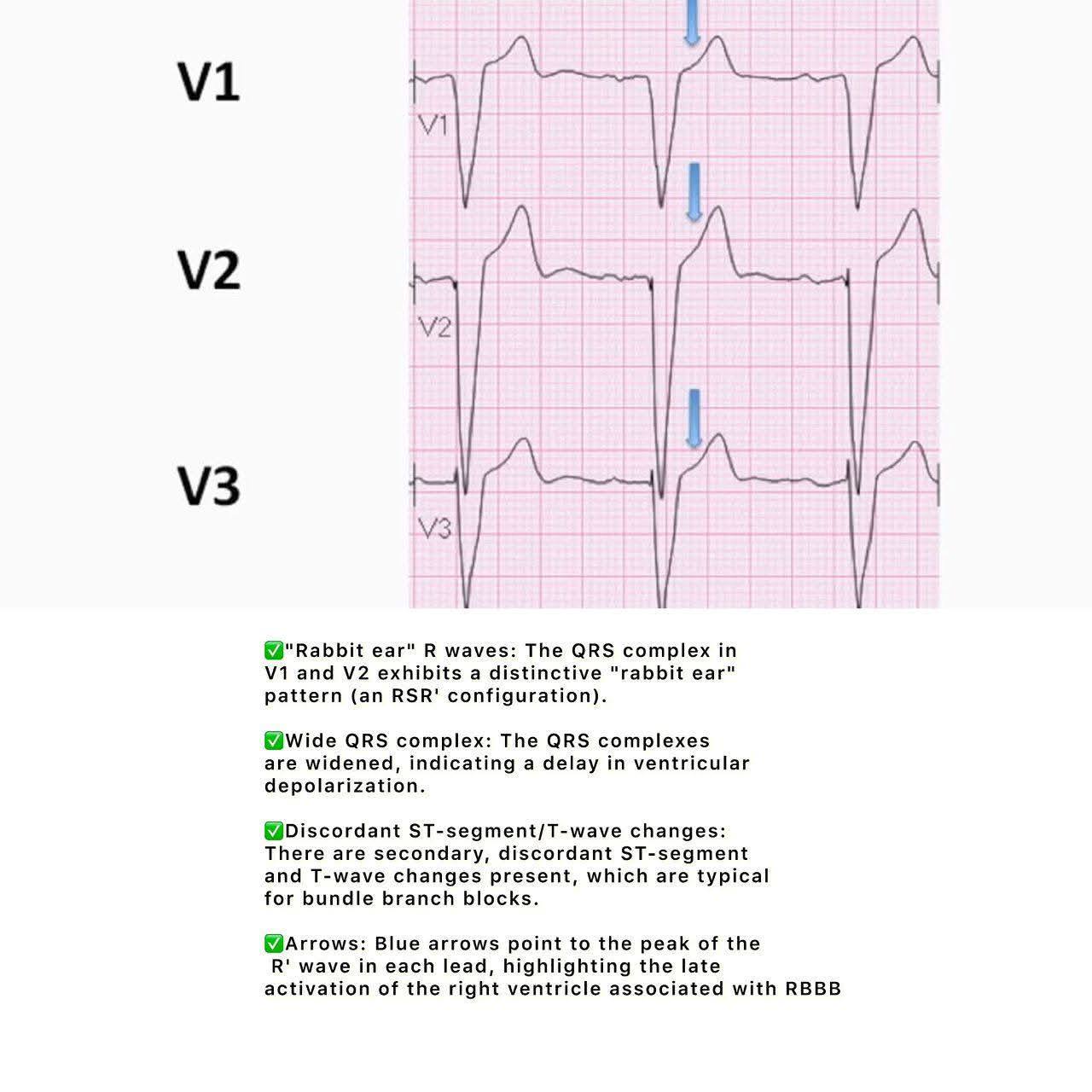 ECG - Mongolia - ECG - Mongolia added a new photo.