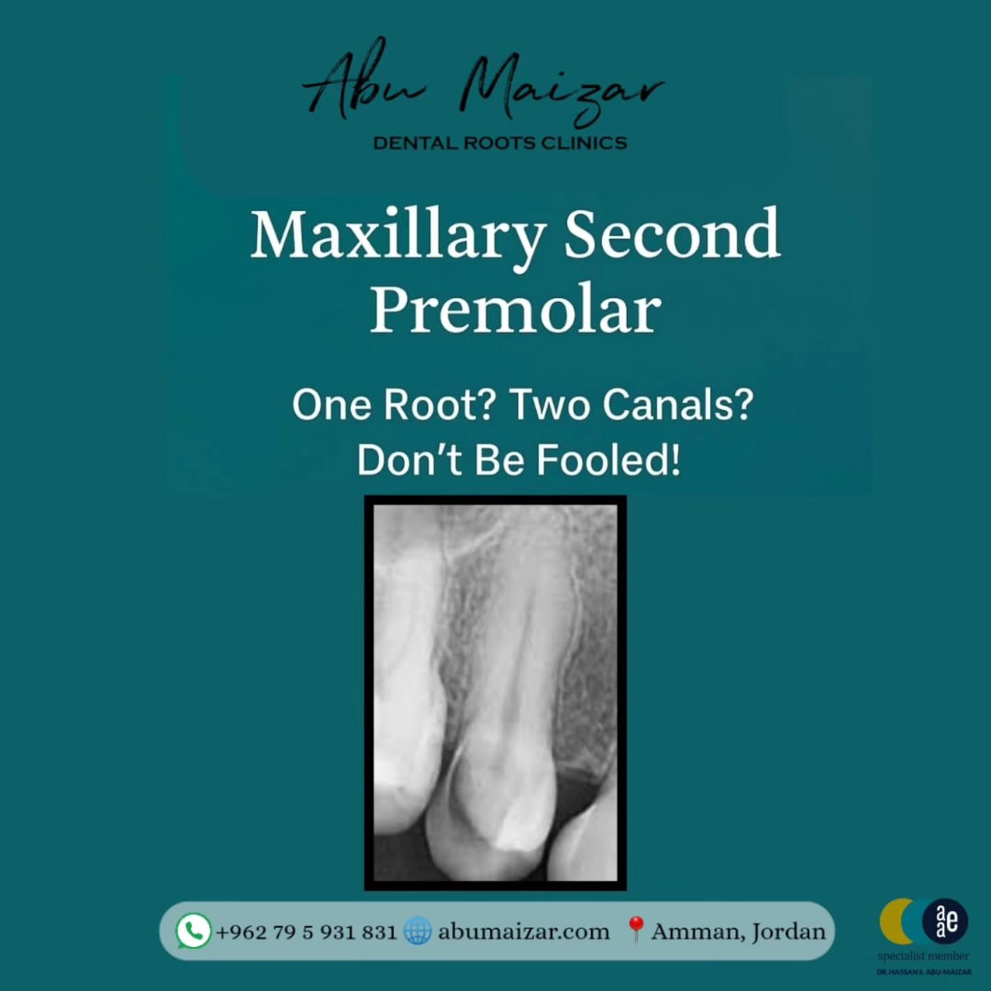 AbuMaizar - Tooth of the Day: Maxillary Second Premolar It may look ...