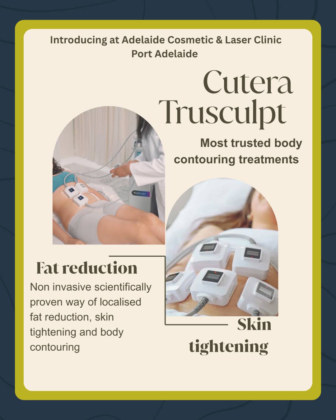 Now available at the Plaza! 👇 Adelaide Cosmetic Laser Clinic has officially launched Cutera TruSculpt, a trusted treatment for localised fat reduction and skin tightening. It's scientifically proven and non-invasive, meaning you