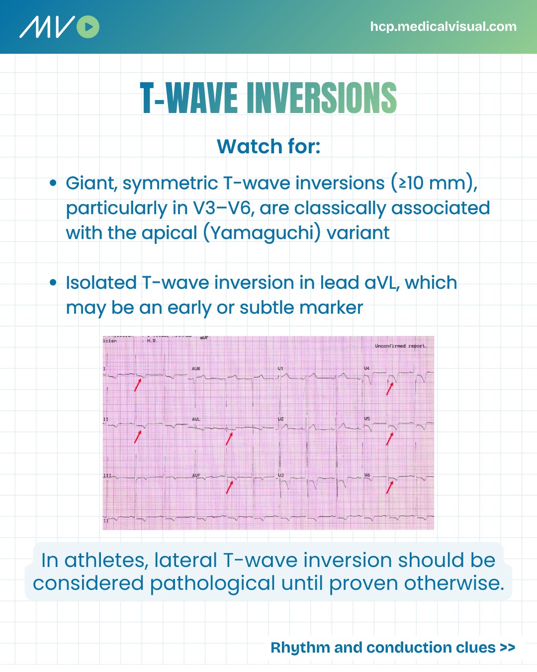 ECG GURU