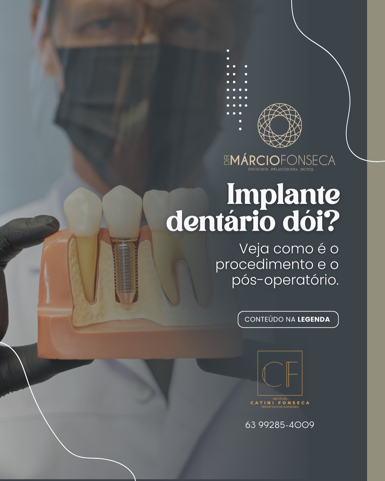 dr-m-rcio-fonseca-endodontia-e-implante-aragua-na-to