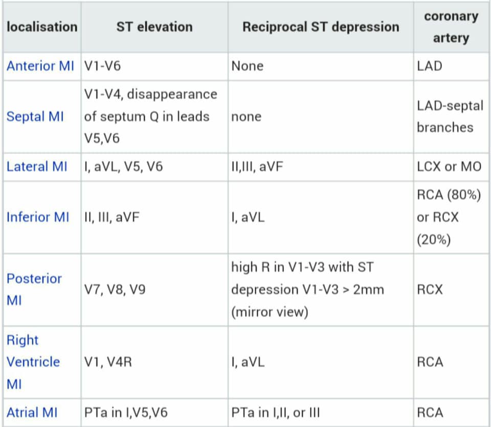Dr.Z.Sultany - Localisation of a Myocardial Infarction... | Facebook