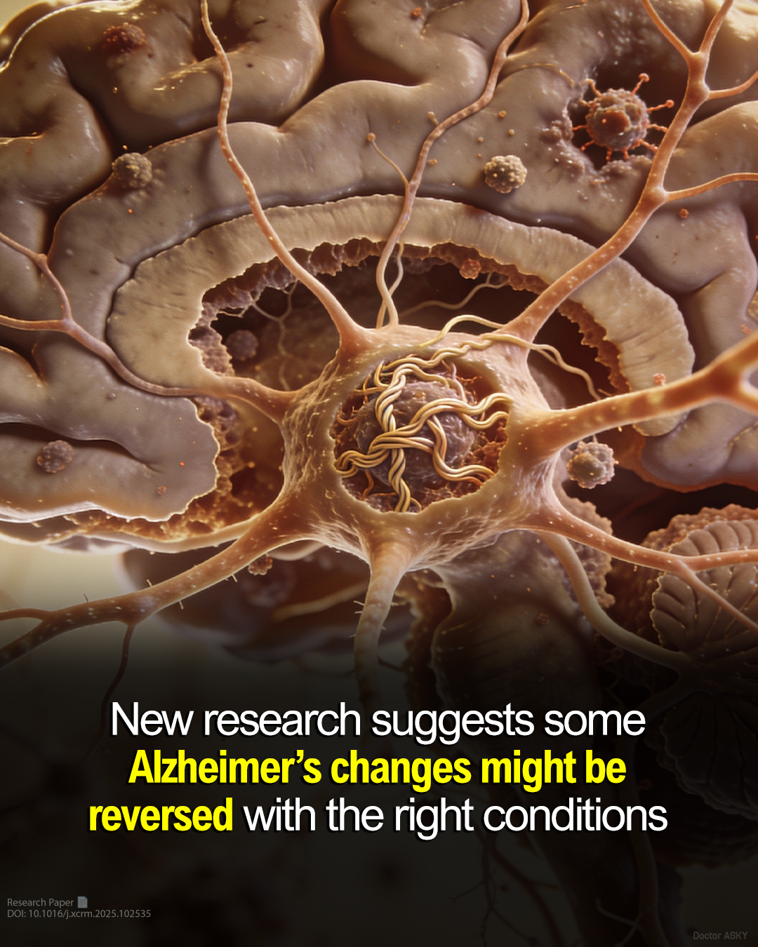 Mimicking key features of sporadic Alzheimer's, the laboratory