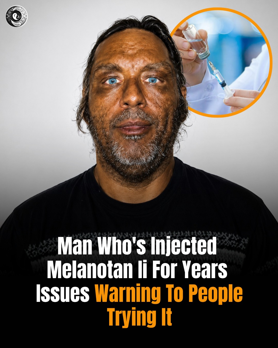 can you take melanotan while pregnant Dermatologists are warning against the viral “Barbie drug” tanning injections (Melanotan II/MTII), saying the unregulated peptide come with side effects like nausea, facial flushing, sexual side effects, and even injection-site abscesses skin radiance cream ghk cu peptide usa Flavors:Mango