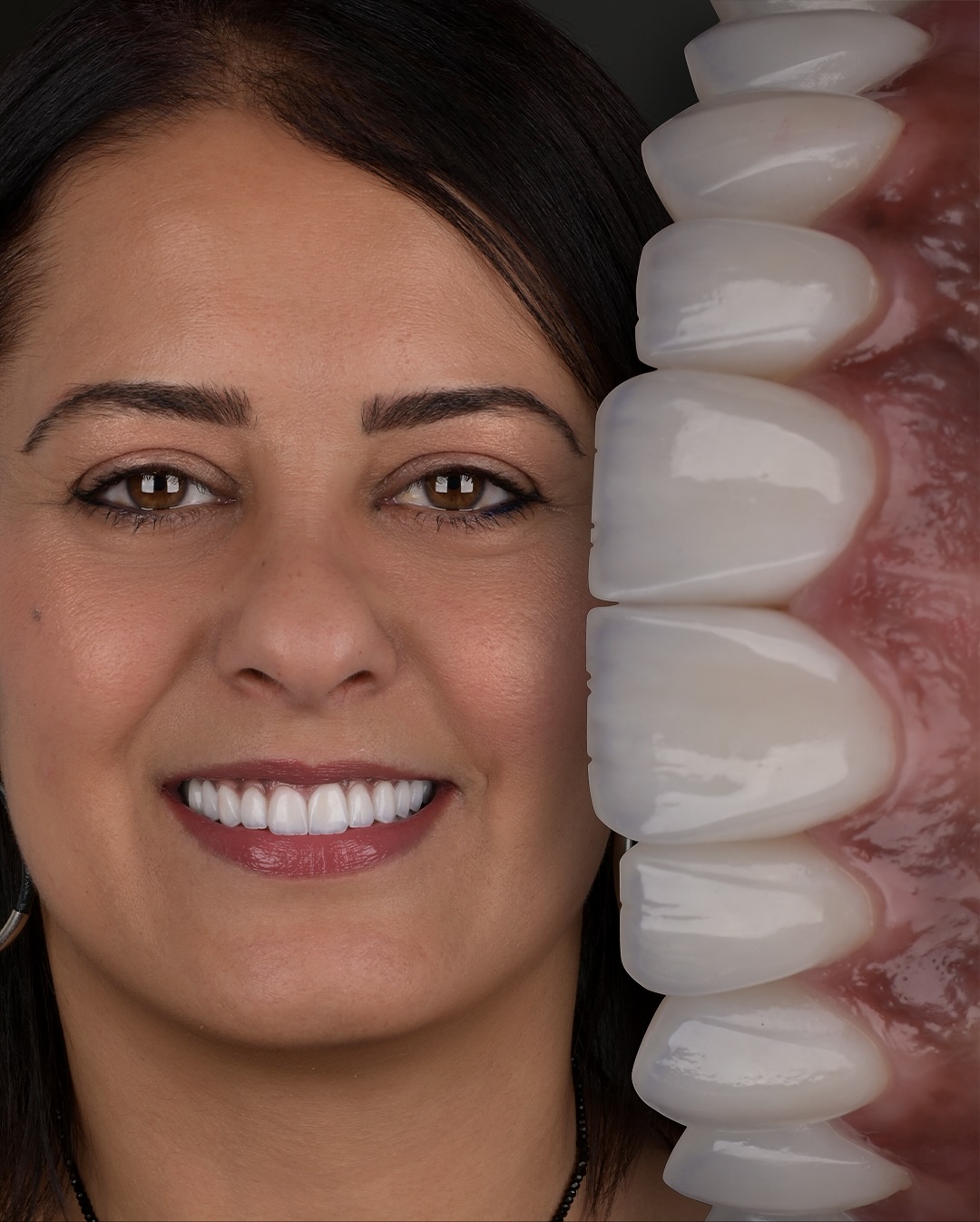 Smile design by... - ד״ר רוכון עתאמנה Dr. Rokon Atamna | Facebook