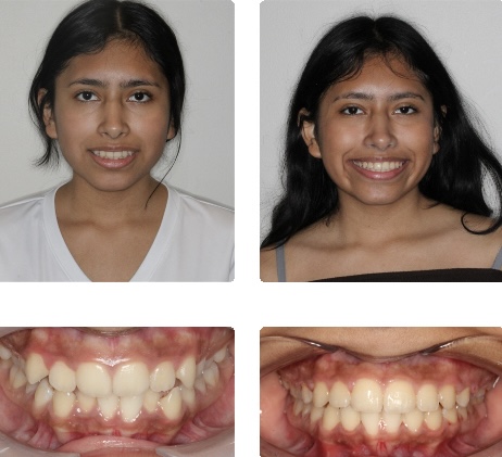 Saint Louis South Orthodontics | St. Louis MO