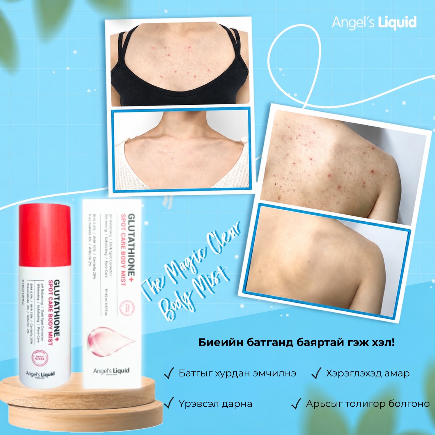 glutathione spot care body mist ✨Angel's Liquid + Биеийн батга болон нөсөө толбоноос салах алдартай шийдэл! Зун болон өвлийн аль ч улиралд нуруу, цээж, гар болон биеийн бусад хэсгээр үүссэн батга болон VITASYM -Cyanocobalamin 250mcg/ml Indications: Dose:400mg (30ml vial) Type_Liquids