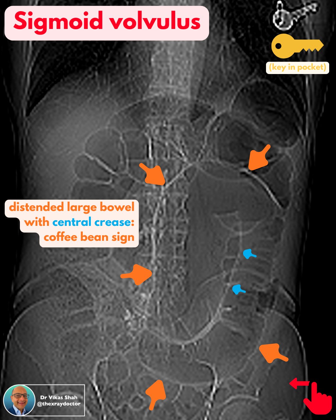 The xray doctor - The key 🔑 to solving this case is... | Facebook