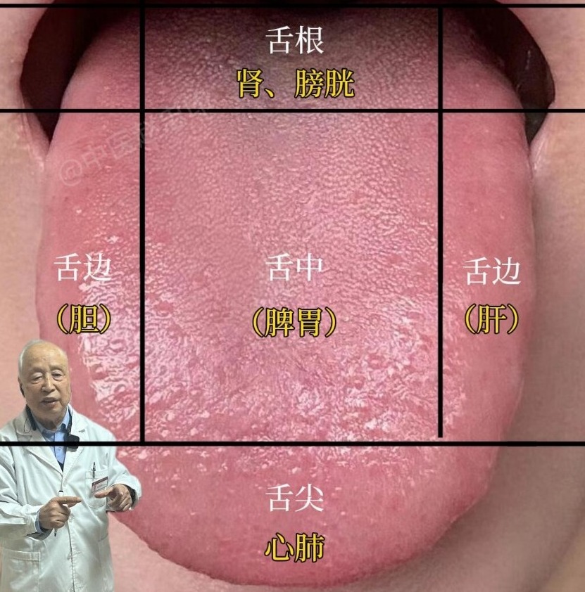 養生-煲湯食譜 | 中醫教你看舌 | Facebook