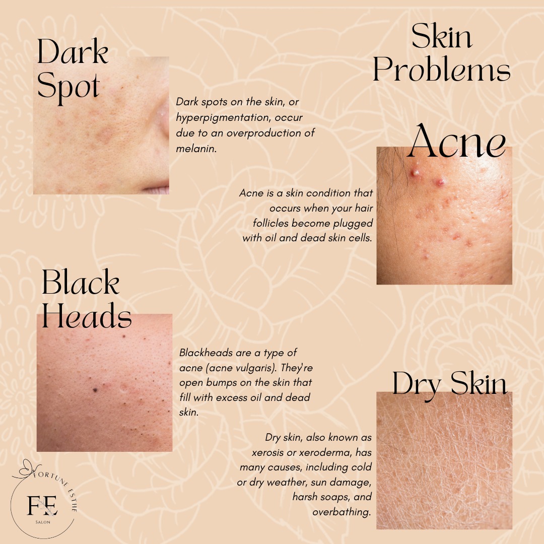 Fortune - Common Skin Problems & What They Mean Understanding your skin ...