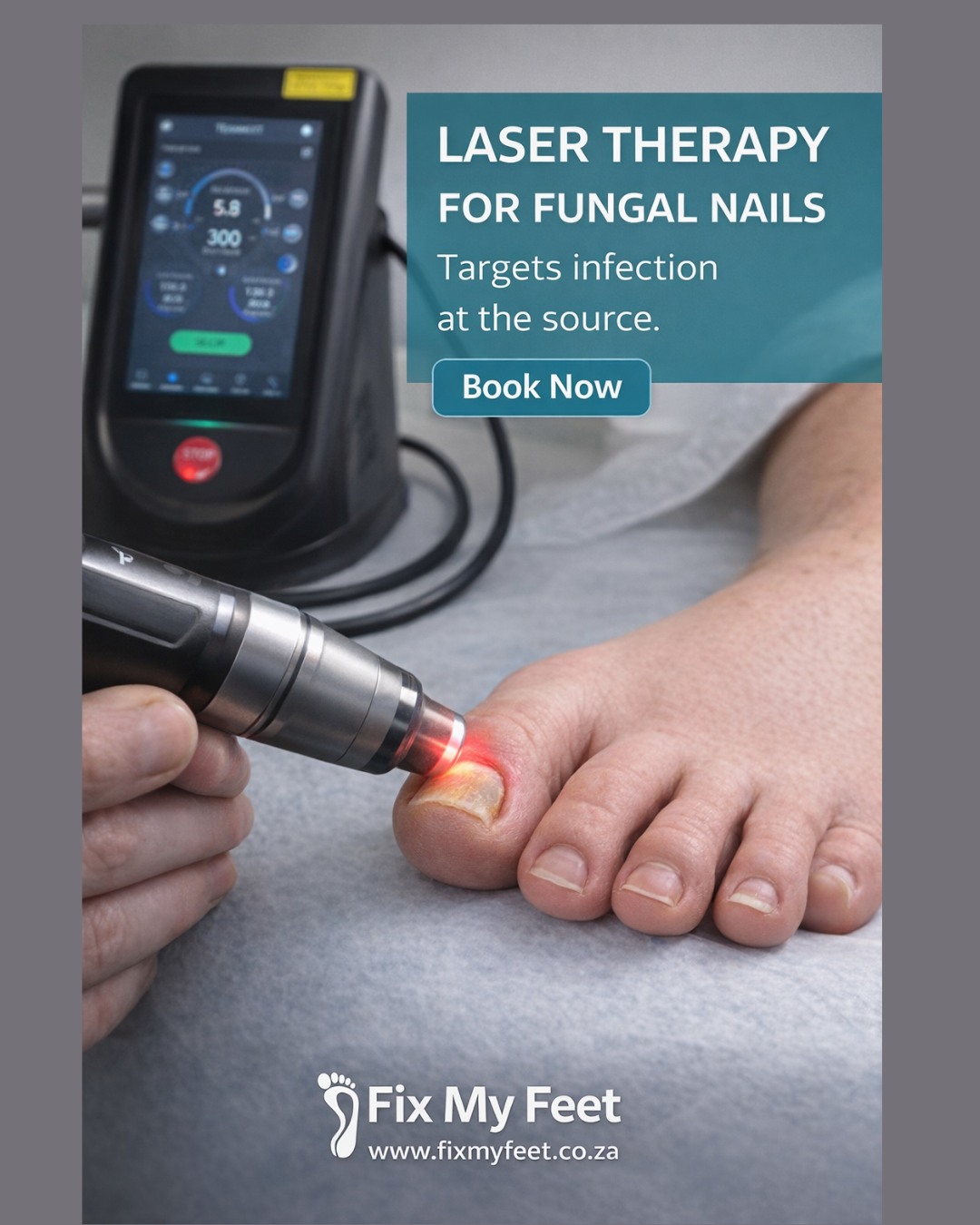 Fix - Laser therapy for fungal nails 🍄 Safe, pain-free, and targets ...