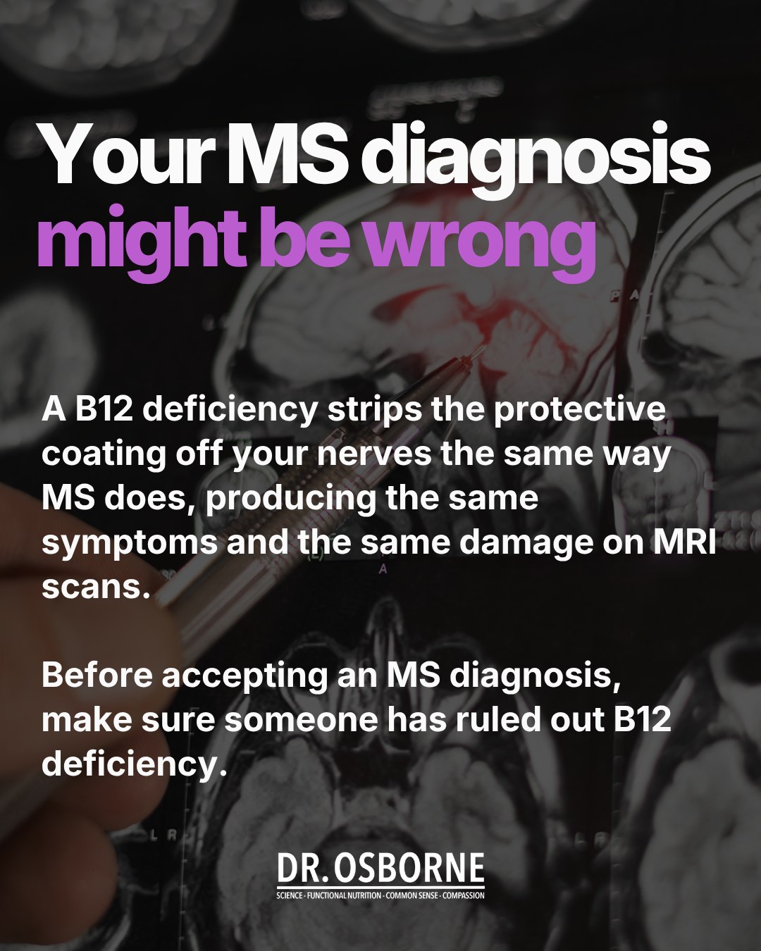 Did anyone have B12 deficiency and then diagnosed with MS?