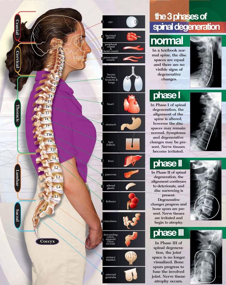 Spine degeneration is the gradual... - Dr. Muhammed Ziya | Facebook