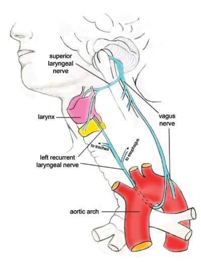 Dr. Muhammed - The recurrent laryngeal nerve (RLN) is a branch of the ...