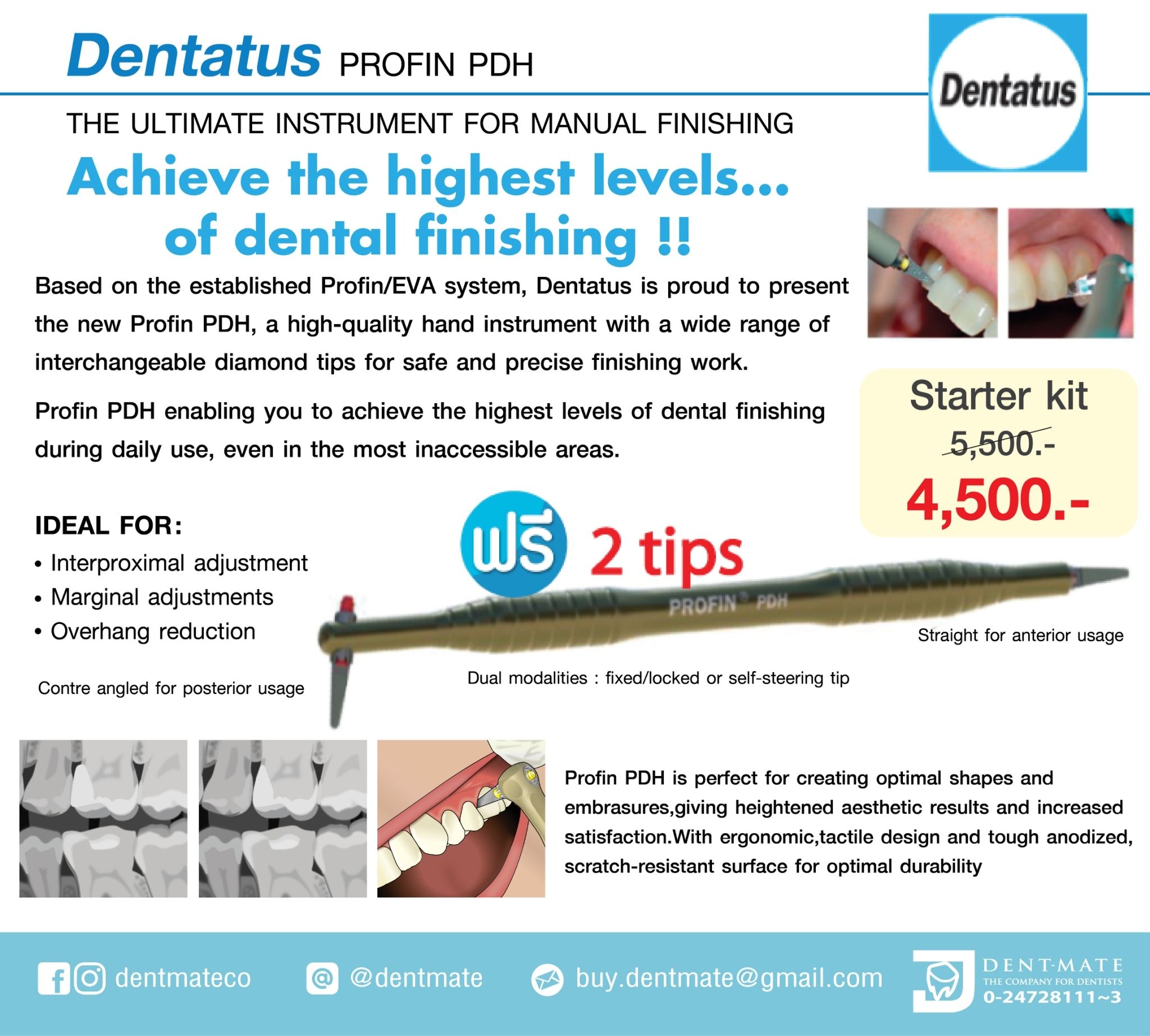 Dent-Mate - 🚩I.P.R. Kit Profin-directional system...