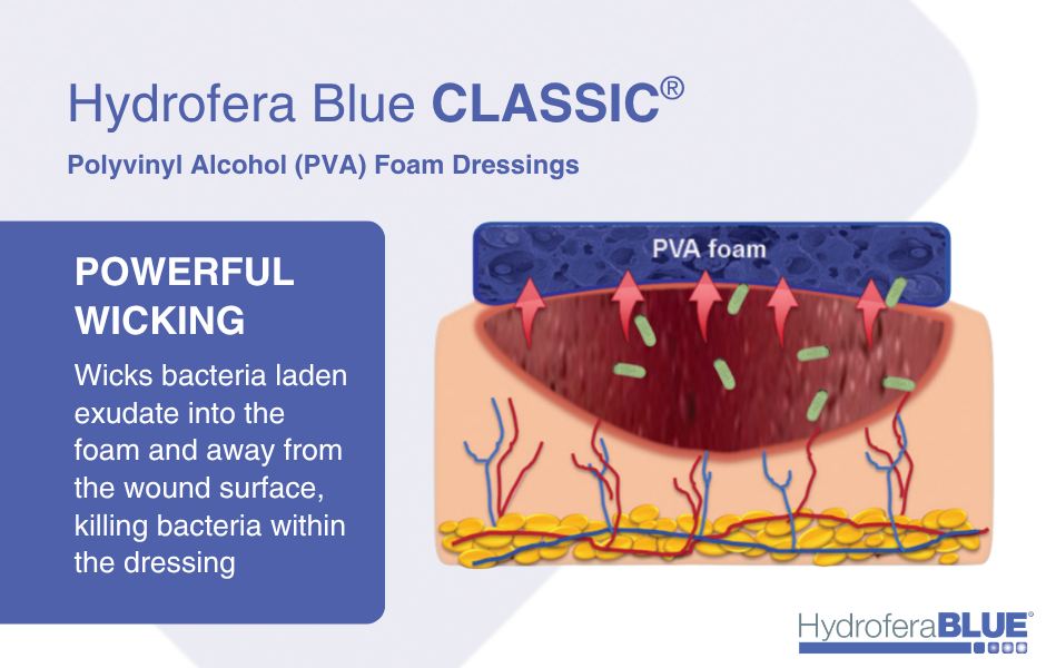 hydrofera blue dressing how to use Bacteriostatic Foam 4" X 4", Box of 10 : Health & Household Hydrofera Blue Ostomy Foam Dressing,